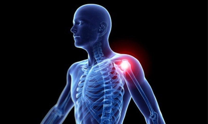 肩周炎是怎么回事，又怎么治呢？