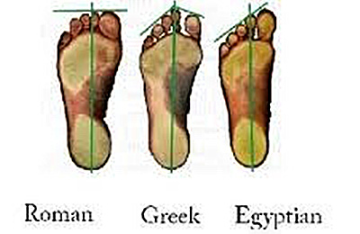 希腊脚 是怎么回事 科学公园